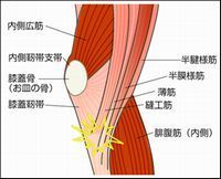 鵞足炎.jpg